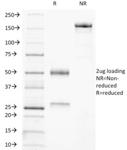 TRACP/PAP/ACP5 Antibody (ACP5/1070), Novus Biologicals 0.2mg; Unlabeled:Antibodies,